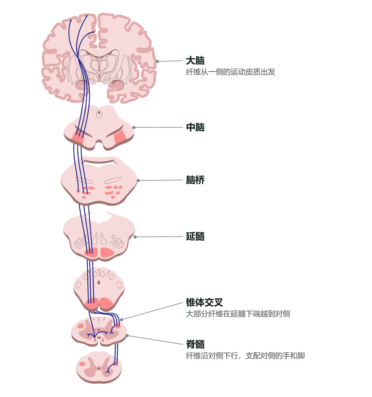 皮质脊髓束走行示意图:运动纤维从一侧大脑的运动皮质出发,经中脑、脑桥、延髓下行,大部分在延髓下端交叉到对侧,再沿脊髓下行