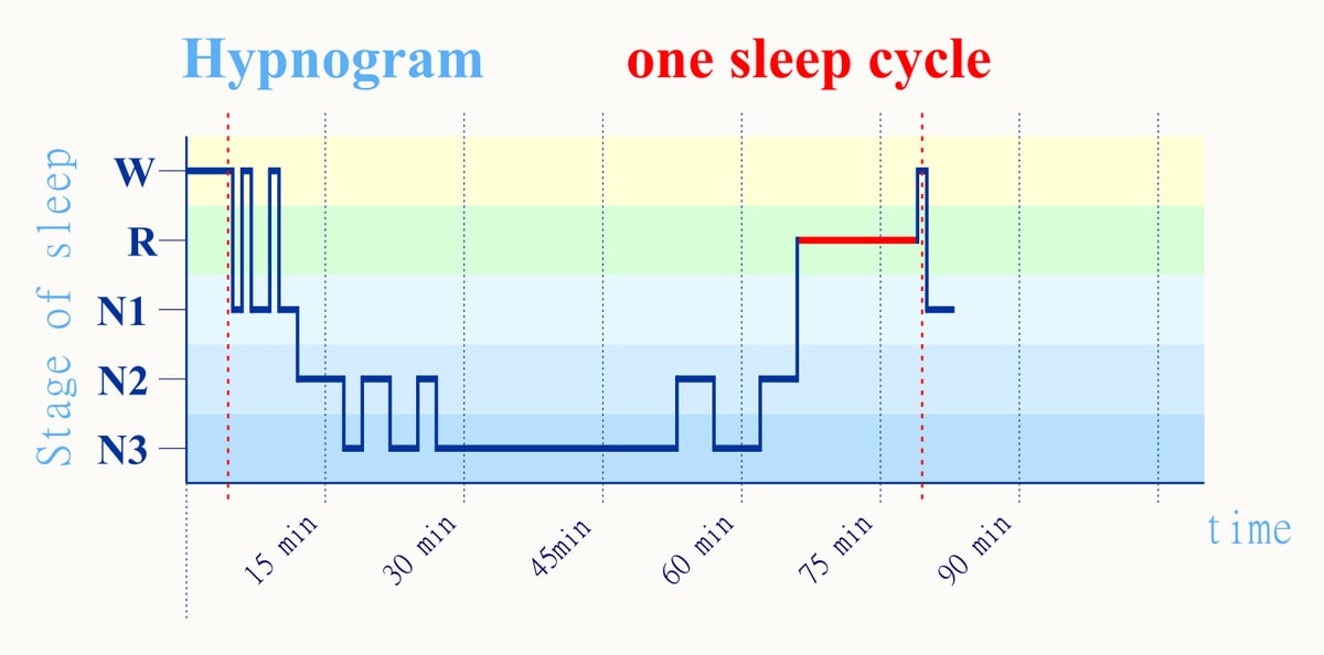 一夜睡眠结构示意图:整夜在浅睡、深睡与快速眼动之间反复循环,周期之间可见短暂的觉醒