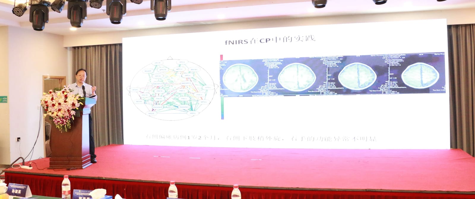 刘维民在舞台左侧讲台作报告,大屏幻灯片标题为「fNIRS 在 CP 中的实践」,并列着四幅脑成像图