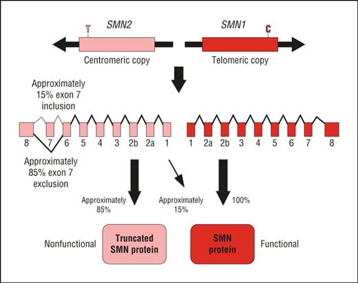 SMN1 与 SMN2 基因结构示意:两者高度同源,SMN2 因一个碱基差异导致第 7 外显子多被剪切掉