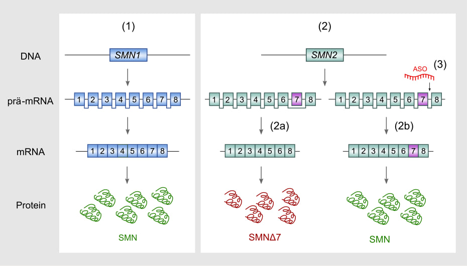 SMN2 剪接示意:SMN2 前体 mRNA 剪接时多数会丢掉第 7 外显子,只产生少量有功能的全长 SMN 蛋白;图中同时标出了反义寡核苷酸的结合位置